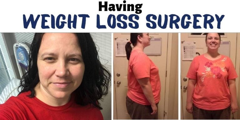 having weight loss surgery 6